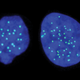 One the left is a haploid cell with 23 chromosomes, and on the right is a diploid cell with 46 chromosomes. Credit: Gloryn Chia/Columbia University Medical Center